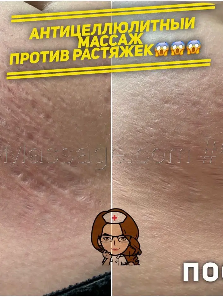 Рината